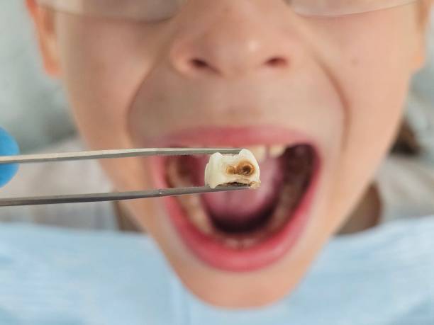  Fairfax, IA Emergency Dentist Pros